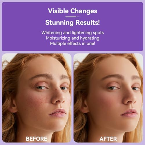 Skin Brightening Serum for Dark Spots on Face & Body - 360ยฐ Roller - 20ml